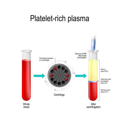 prf centrifuge|prf vs prp pubmed.